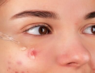 Fighting-Warts-IndiaWest-India-West