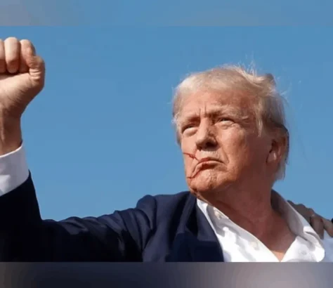 Is Trump Going To Be Softer, Mellower After Shooting Experience?