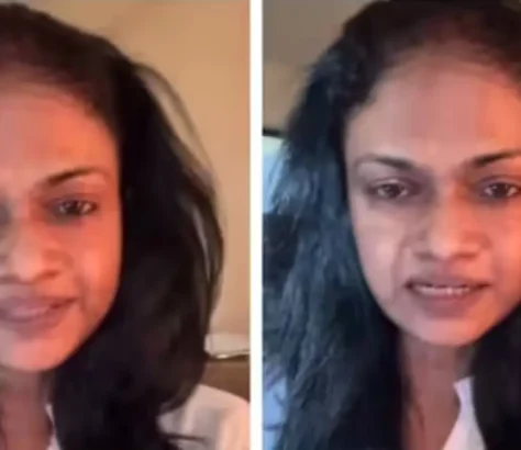 Singer Suchitra Accuses Fiancé Of Physical Abuse, Fraud