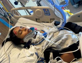 San Jose Girl In Month-Long Coma, Community Looking For Help