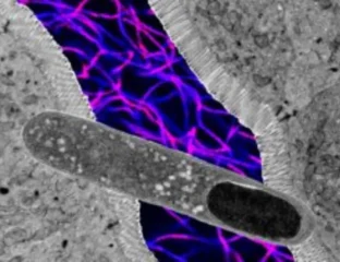 US Researchers Identify Gut Bacteria That Aids Weight Loss