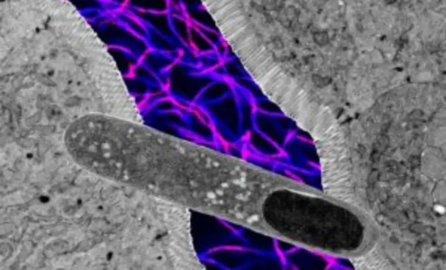 US Researchers Identify Gut Bacteria That Aids Weight Loss