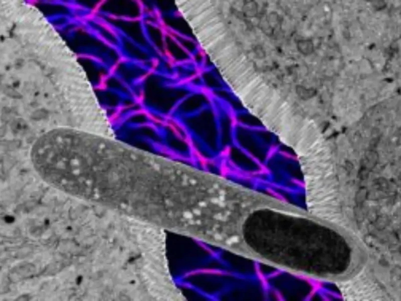 US Researchers Identify Gut Bacteria That Aids Weight Loss