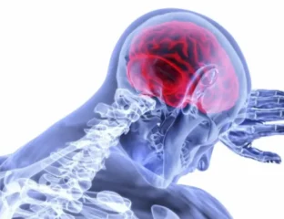 High-Salt Diet Speeds Memory Decline in Men