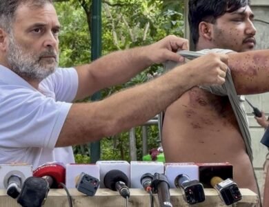 Rahul Gandhi: Police Used Pellets on Protesting Students