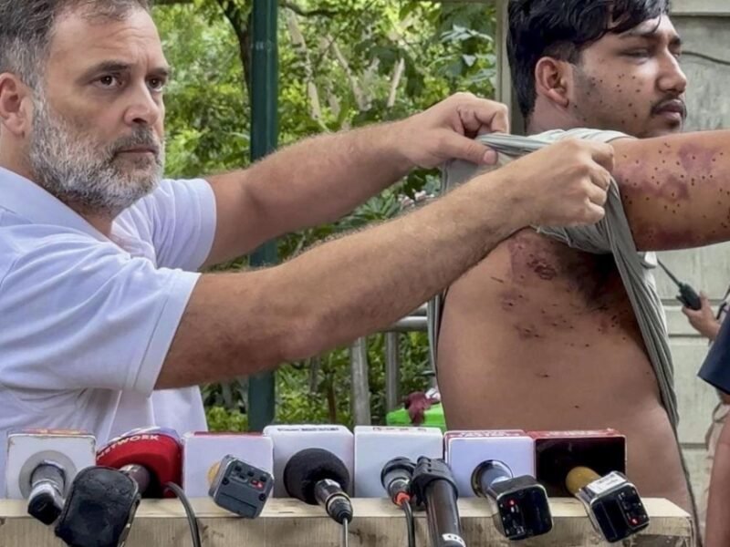 Rahul Gandhi: Police Used Pellets on Protesting Students